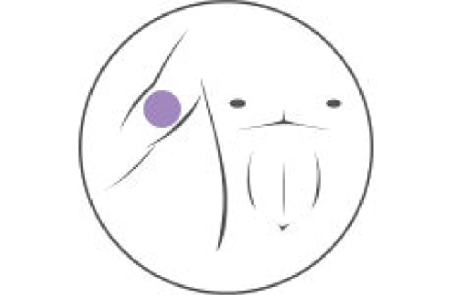 Peripherally-Inserted-Central-Catheters-PICCs_resized.png
